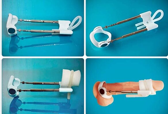 penis enlargement extender